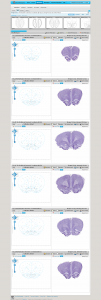 BrainNavigator - Workspace